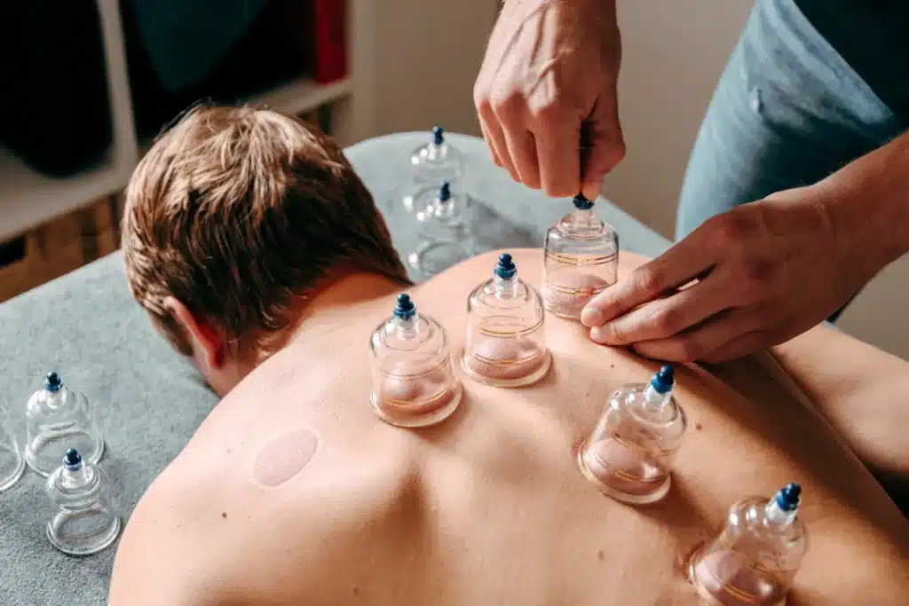 Cupping reusel